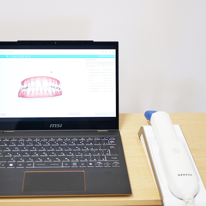 口腔内スキャナー