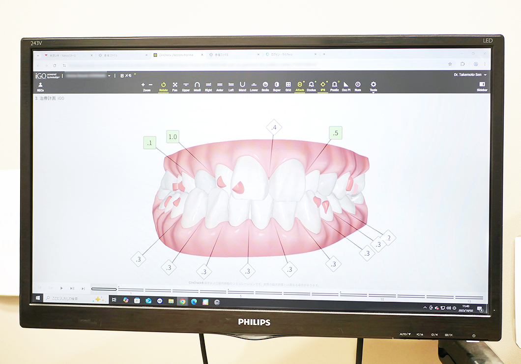 診断と治療計画の説明