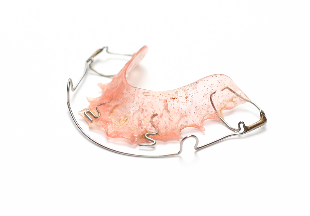 歯並びを安定させる期間（保定期間）