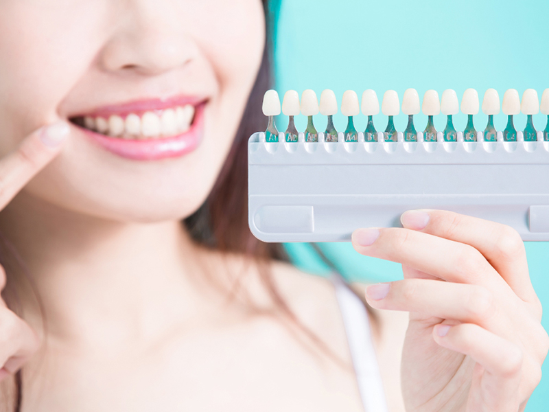 ホワイトニング